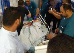 إصابة خطيرة جدا برصاص الاحتلال غرب رام الله