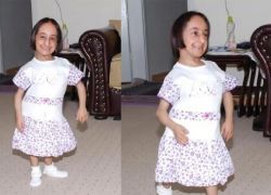 وفاة إحدى أقصر النساء في العالم عن 33 عاماً