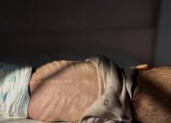 4 حالات وفاة جديدة نتيجة المجاعة خلال يوم لترتفع الحصيلة لـ239