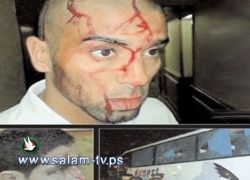 زاهر في الفيفا بسبب الطوبة