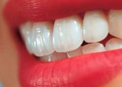 الوصفة السحرية للتخلص من تسوس الاسنان بشكل فوري!