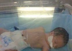 مشفى الخليل ينقذ طفلا من بطن امه المتوفيه