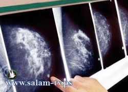 سرطان الثدي يصيب الرجال بشكل نادر ولكن بشراسة