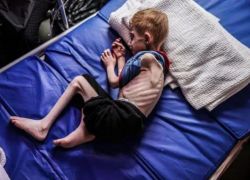 7 وفيات نتيجة التجويع في غزة خلال الساعات الماضية