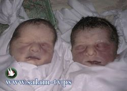 نام الطبيب فمات التوأم: مواطن غزي يتهم مشفى الشفاء بقتل توأميه