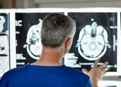 فحوص الأشعة المقطعية تكتشف الاكتئاب قبل الإصابة به