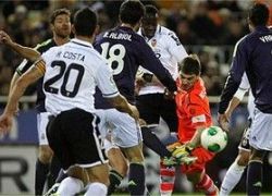 فيديو : كاسياس يصاب في يده اثر ضربة من زميله