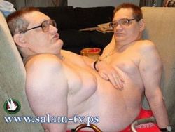 أكبر توأمين ملتصقين في العالم
