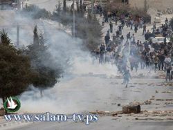 شاب من سلوان يفقد بصره نتيجة الغاز المسيل للدموع